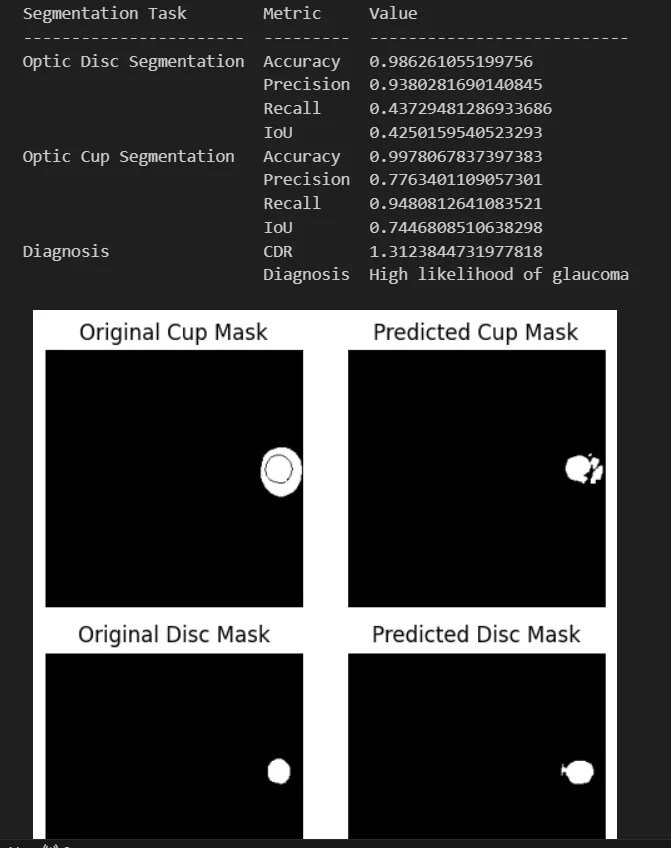 Predicted vs original cup/disc masks